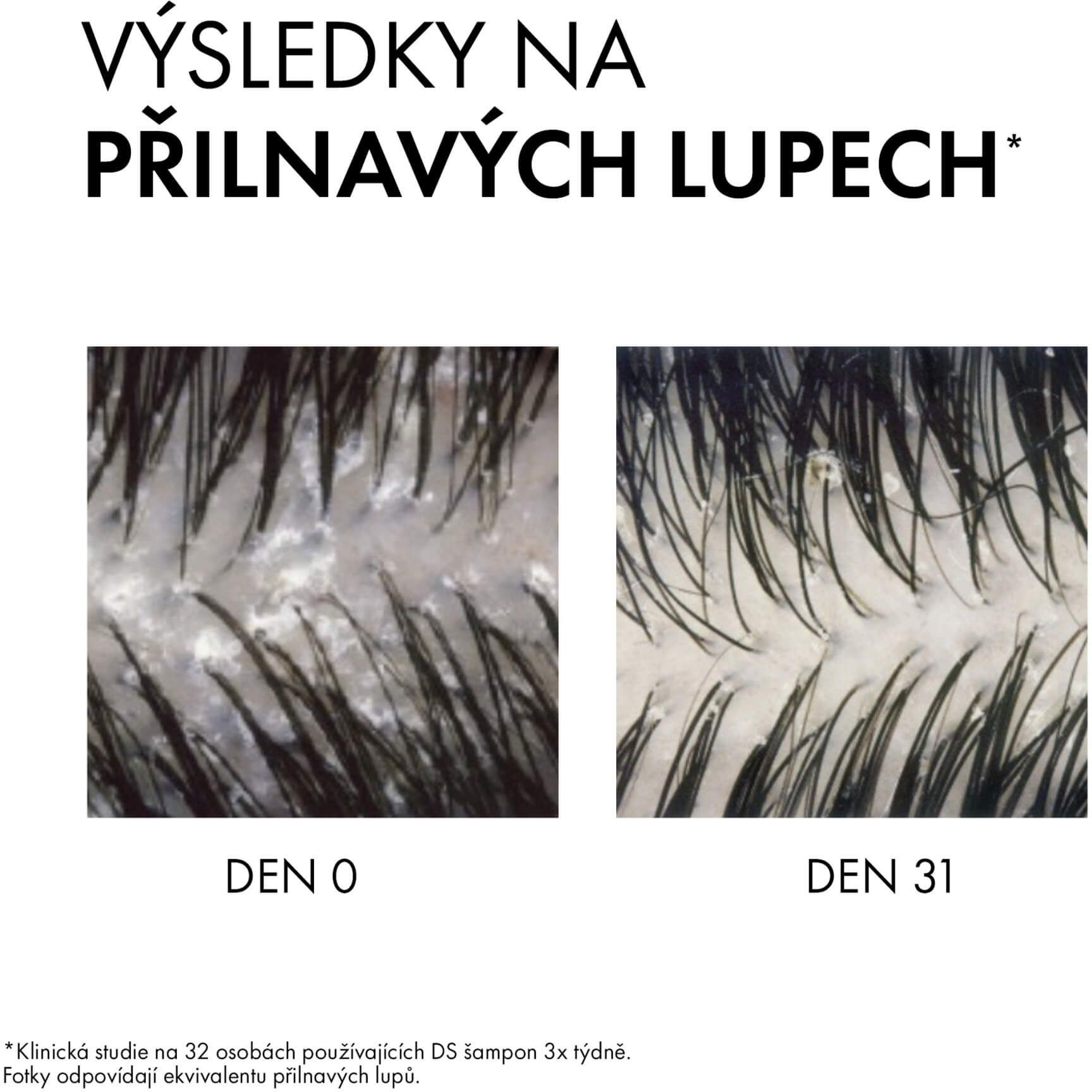 Vichy DERCOS Šampón proti lupům se SELENIEM DS pro suché vlasy - náhradní náplň 390 ml