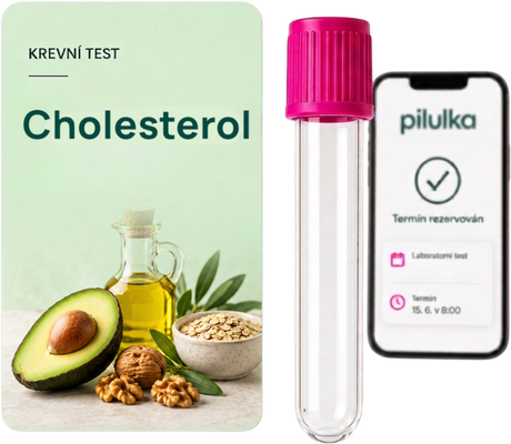 Unilabs Krevní test na cholesterol