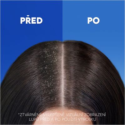 Head & Shoulders Menthol Fresh, Šampon proti lupům 400 ml