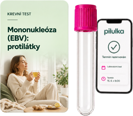 Unilabs Mononukleóza (EBV): hladina protilátek
