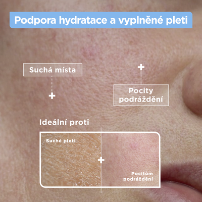 Mixa Sensitive Skin Expert Hydratační sérum proti vysušení, 30 ml