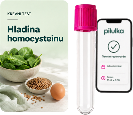 Unilabs Srdce a cévy: homocystein